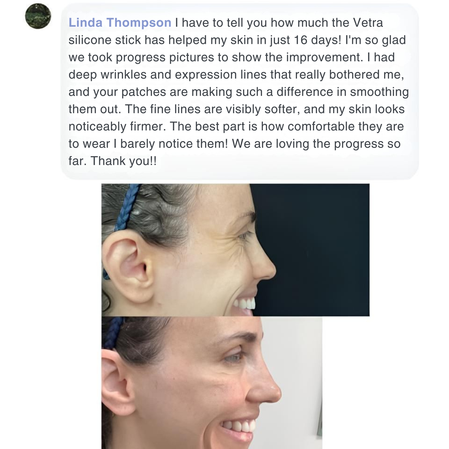 SILICONE SCAR & WRINKLE SOLUTIONS STICK