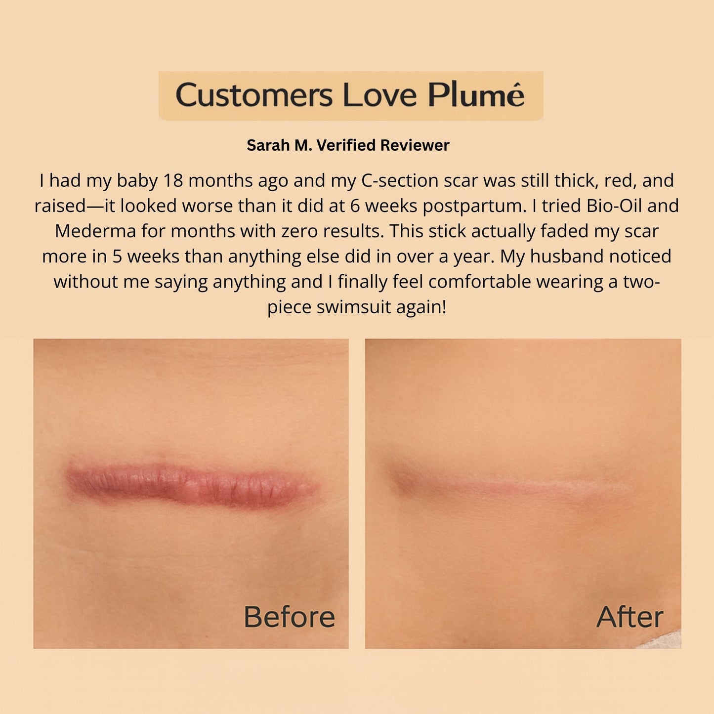 SILICONE SCAR & WRINKLE SOLUTIONS STICK