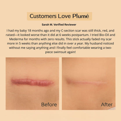 SILICONE SCAR & WRINKLE SOLUTIONS STICK